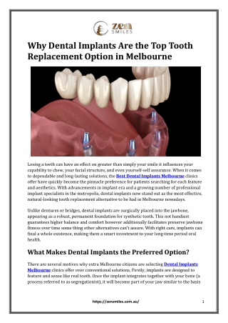 Why Dental Implants Are the Top Tooth Replacement Option in Melbourne