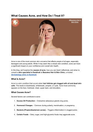 What Causes Acne, and How Do I Treat It