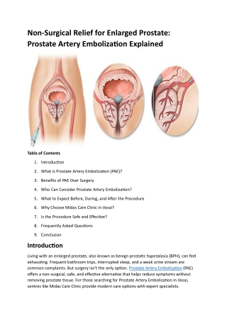 Non-Surgical Relief for Enlarged Prostate Prostate Artery Embolization Explained
