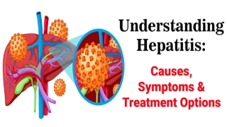 Understanding Hepatitis: Causes, Symptoms & Treatment Options