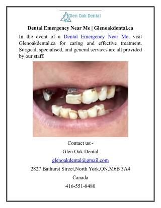 Dental Emergency Near Me  Glenoakdental.ca