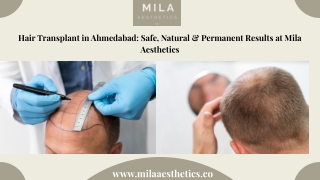 Hair Transplant in Ahmedabad Safe, Natural & Permanent Results at Mila Aesthetics