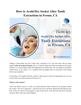 How to Prevent Dry Socket Following a Tooth Extraction in Fresno, CA