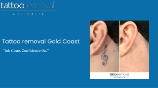 Tattoo removal Gold Coast  - Tattoo removal Australia (1)