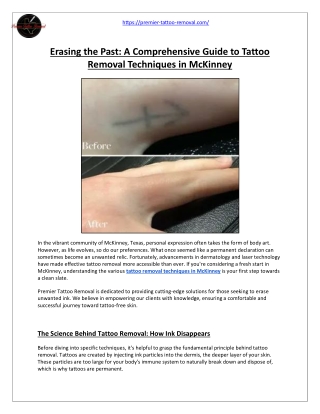 Tattoo Removal Techniques in McKinney