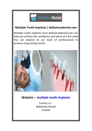 Multiple Tooth Implants Ballantraedental.com