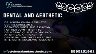 Braces Treatment Clinic In Dwarka