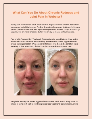 What Can You Do About Chronic Redness and Joint Pain in Webster