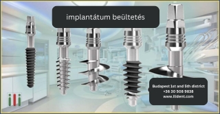 implantátum beültetés
