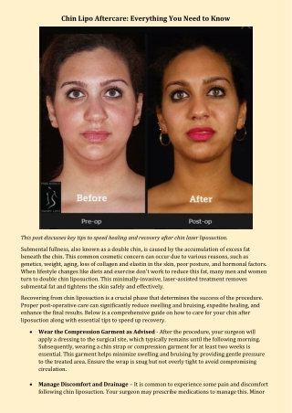 Chin Lipo Aftercare Everything You Need to Know