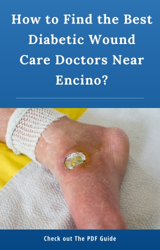 How to Find the Best Diabetic Wound Care Doctors Near Encino?