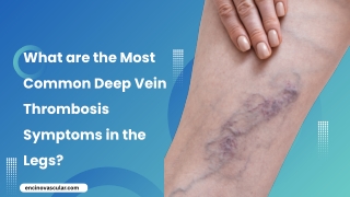 What are the Most Common Deep Vein Thrombosis Symptoms in the Legs?