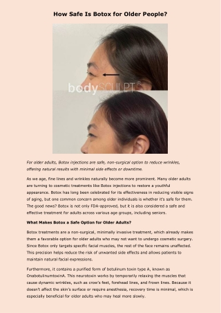 How Safe Is Botox for Older People