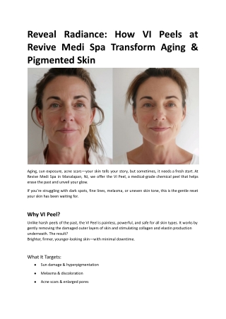 Reveal Radiance How VI Peels at Revive Medi Spa Transform Aging & Pigmented Skin.docx