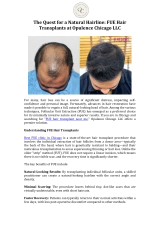The Quest for a Natural Hairline FUE Hair Transplants at Opulence Chicago LLC