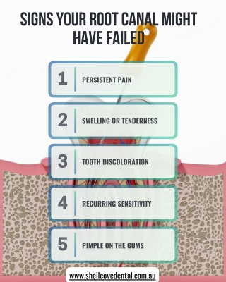 Signs Your Root Canal Might Have Failed
