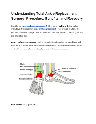 Understanding Total Ankle Replacement Surgery_ Procedure, Benefits, and Recovery