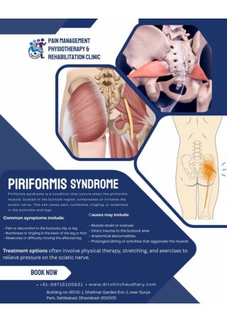 Piriformis Syndrome | Pain Management Physiotherapy & Rehabilitation Clinic