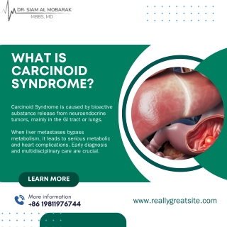 dr siam pdf Carcinoid Syndrome