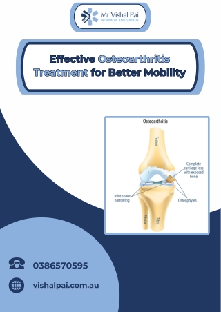 Effective Osteoarthritis Treatment for Better Mobility