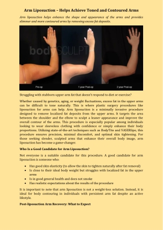 Arm Liposuction – Help Achieve a Toned and Contoured Arms