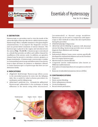 Essentials of Hysteroscopy