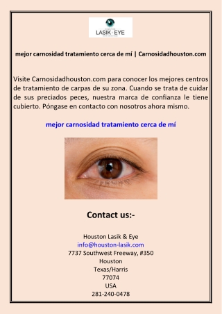 mejor carnosidad tratamiento cerca de mí Carnosidadhouston.com