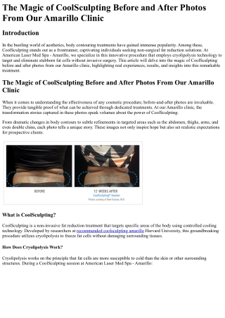 The Magic of CoolSculpting Before and After Photos From Our Amarillo Clinic