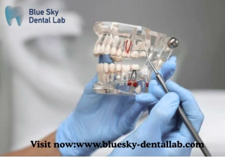 Malo Bridge Prosthesis Solutions for Lasting Smiles | Blue Sky Dental Lab
