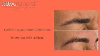 Eyebrow tattoo removal Brisbane - Tattoo Removal Australia