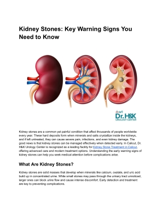 Kidney Stones_ Key Warning Signs You Need to Know