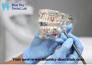 Malo Bridge Dental Implant Solutions for Lasting Smiles | Blue Sky Dental Lab