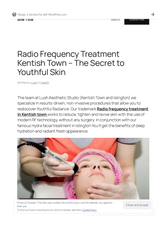 Radio Frequency Treatment Kentish Town – The Secret to Youthful Skin