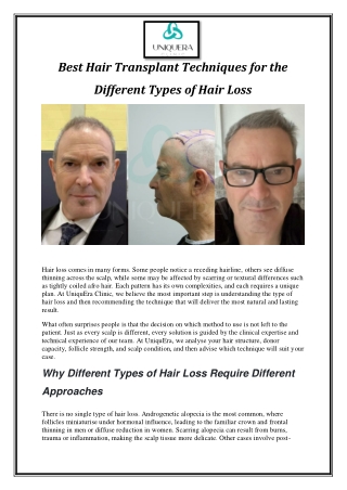 Best Hair Transplant Techniques for the Different Types of Hair Loss