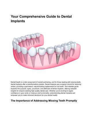 dental implants near me