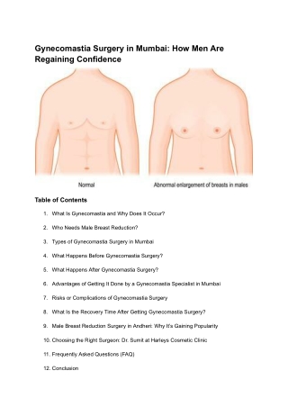 Gynecomastia Surgery in Mumbai_ How Men Are Regaining Confidence