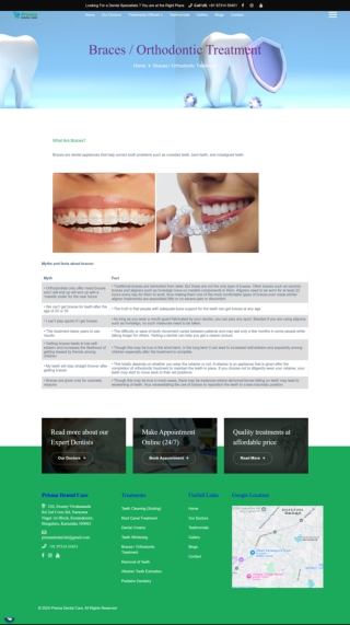 Braces and Orthodontic Treatment in Kanakapura Road Konanakunte Cross