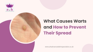 What Causes Warts and How to Prevent Their Spread