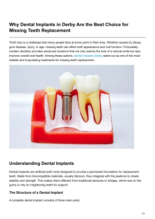 Why Dental Implants in Derby Are the Best Choice for Missing Teeth Replacement