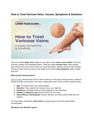 How to Treat Varicose Veins_ Causes, Symptoms & Solutions