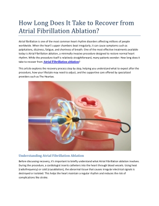 How Long Does It Take to Recover from Atrial Fibrillation Ablation