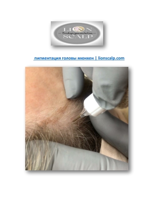 пигментация головы мюнхен | lionscalp.com