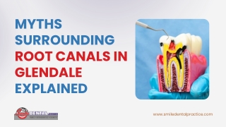 Myths Surrounding Root Canals in Glendale Explained