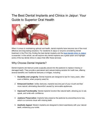 The Best Dental Implants and Clinics in Jaipur: Your Guide to Superior Oral Heal