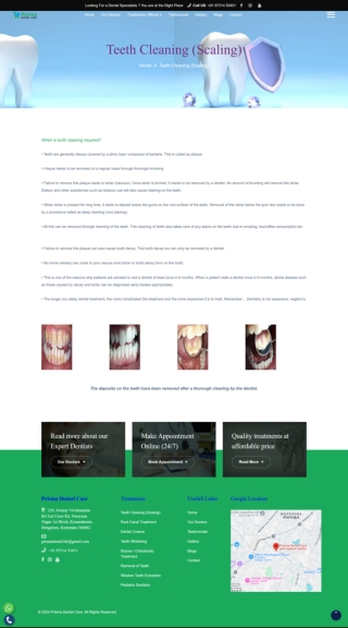 Teeth Cleaning or Scaling in Kanakapura Road Konanakunte Cross