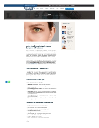 Yellow Eyes (Jaundice Eyes) Causes, Symptoms & Treatments