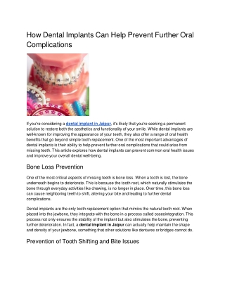 How Dental Implants Can Help Prevent Further Oral Complications