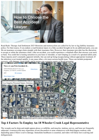 Bike Crashes And Roadway Rash: How To Look For Compensation For Severe Skin Inju