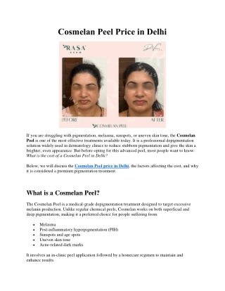 Cosmelan Peel Price in Delhi