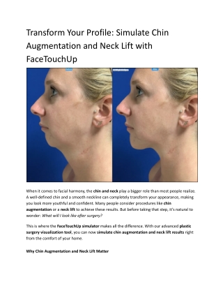 Transform Your Profile_ Simulate Chin Augmentation and Neck Lift with FaceTouchUp